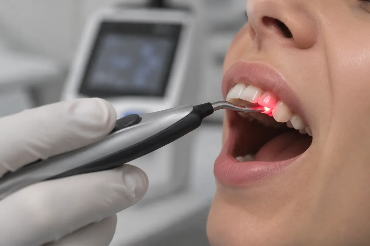 Caries Detection Laser